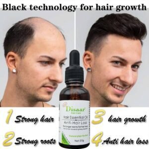 Reparação do folículo capilar Crescimento capilar Óleo de essência de plantas