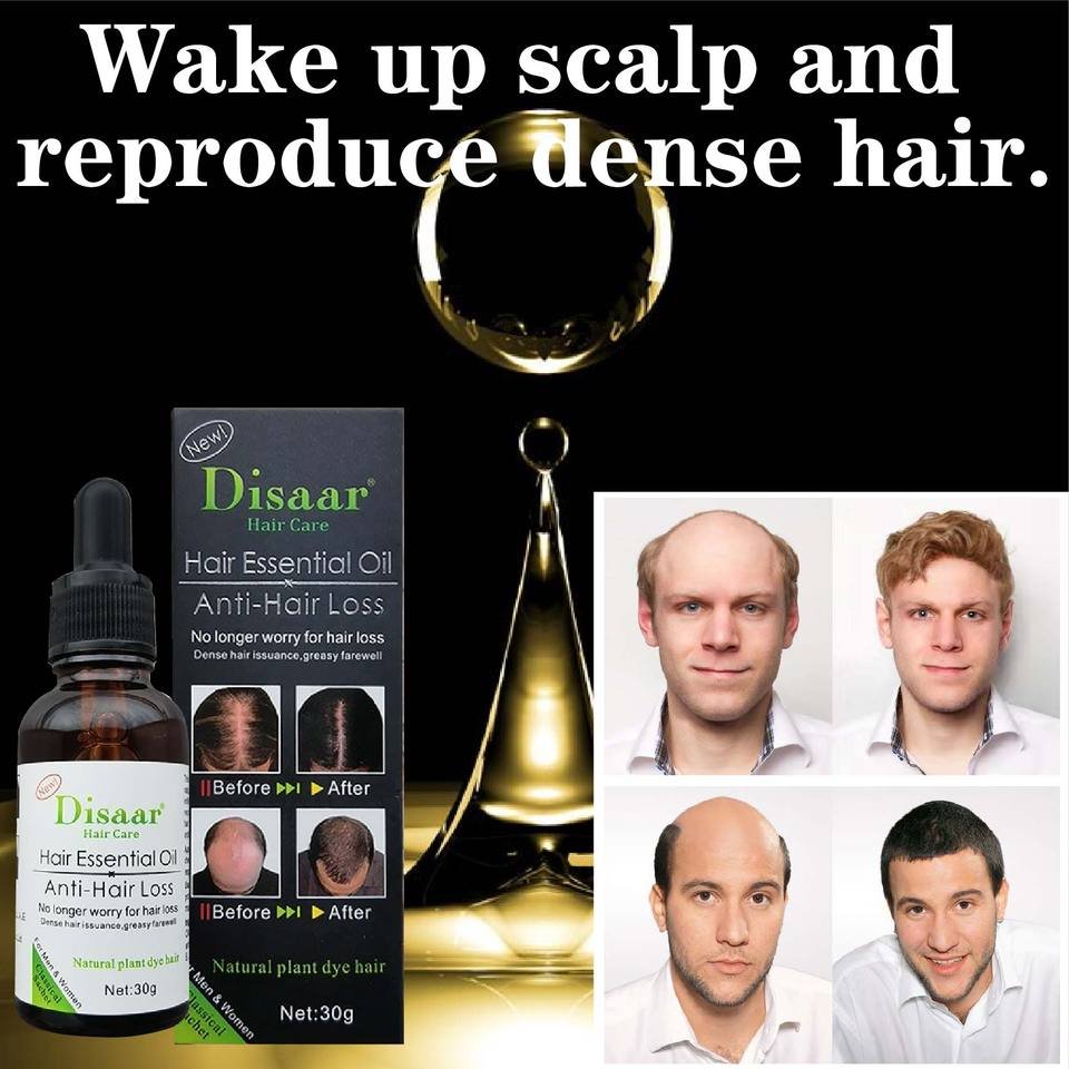 Reparação do folículo capilar Crescimento capilar Óleo de essência de plantas - Image 5